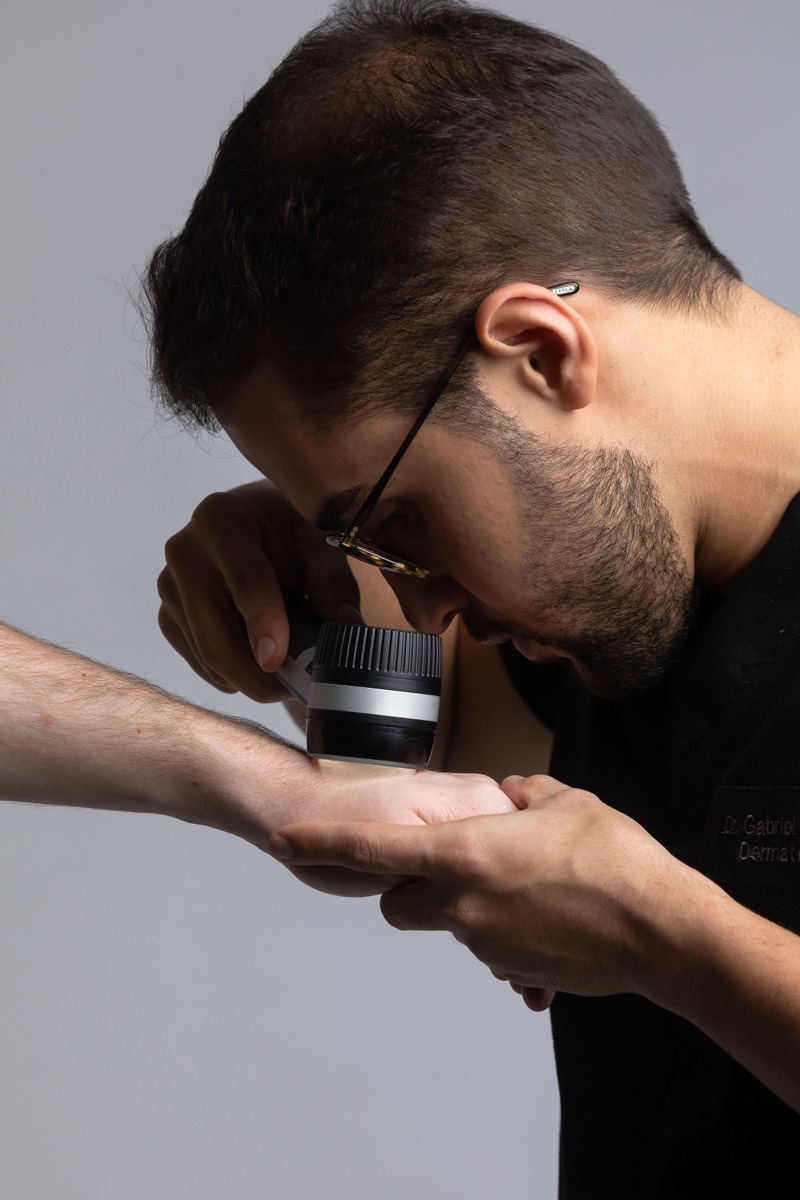 Avaliação de lesão com dermatoscópio